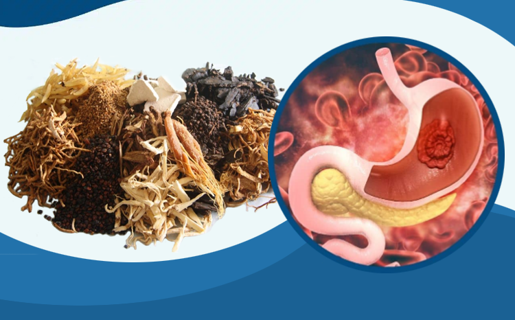 Bài thuốc đông y trị viêm loét dạ dày tá tràng